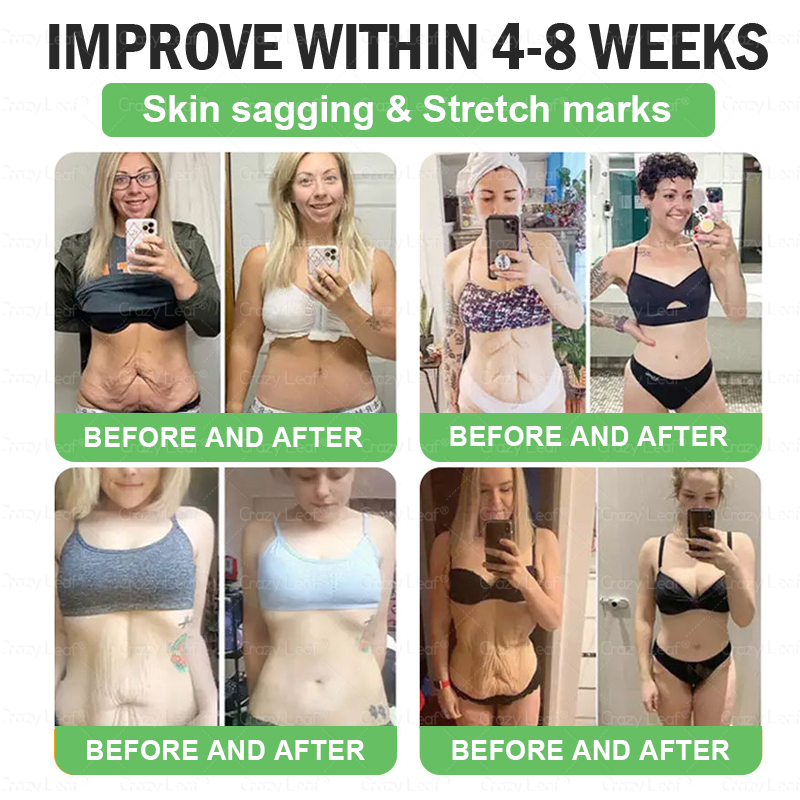 𝐂𝒓𝓪𝙯𝙮𝐋𝑒𝑎𝐟® 𝚂𝖬𝐺𝘛-𝘎𝐿𝙋-1 𝑆𝘭𝘪𝘮 & 𝘝𝘪𝘵𝘢𝘭𝘪𝘵𝘺 𝖮𝗋𝖺𝗅 𝑆olution 𝗍𝖺𝗋𝗀𝖾𝗍𝗌 𝑡𝑢𝑏𝑏𝑜𝑟𝑛 𝑤𝑒𝑖𝑔ℎ𝑡, ℎ𝑖𝑔ℎ 𝑏𝑙𝑜𝑜𝑑 𝑝𝑟𝑒𝑠𝑠𝑢𝑟𝑒, 𝑏𝑙𝑜𝑜𝑑 𝑠𝑢𝑔𝑎𝑟 ,𝘧𝘢𝘵𝘵𝘺 𝘭𝘪𝘷𝘦𝘳, 𝘫𝘰𝘪𝘯𝘵 𝘱𝘢𝘪𝘯, 𝘧𝘢𝘵𝘪𝘨𝘶𝘦,𝑙𝑜𝑤 𝑒𝑛𝑒𝑟𝑔𝑦, 𝑠𝑎𝑔𝑔𝑖𝑛𝑔 𝑠𝑘𝑖𝑛 & 𝑚𝑜𝑟𝑒 𝑓𝑜𝑟 𝑏𝑒𝑡𝑡𝑒𝑟 ℎ𝑒𝑎𝑙𝑡ℎ & 𝑣𝑖𝑡𝑎𝑙𝑖𝑡𝑦