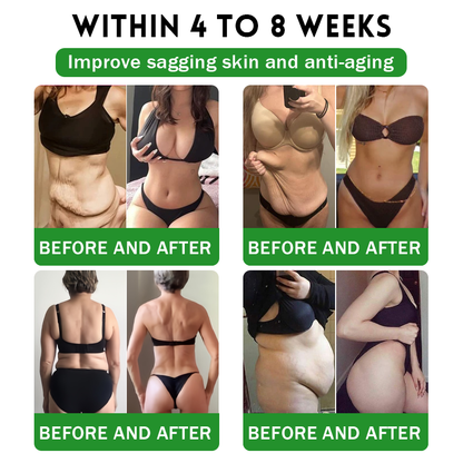 𝐂𝒓𝓪𝙯𝙮𝐋𝑒𝑎𝐟® 𝚂𝖬𝐺𝘛-𝘎𝐿𝙋-1 𝑆𝘭𝘪𝘮 & 𝘝𝘪𝘵𝘢𝘭𝘪𝘵𝘺 𝖮𝗋𝖺𝗅 𝑆olution 𝗍𝖺𝗋𝗀𝖾𝗍𝗌 𝑡𝑢𝑏𝑏𝑜𝑟𝑛 𝑤𝑒𝑖𝑔ℎ𝑡, ℎ𝑖𝑔ℎ 𝑏𝑙𝑜𝑜𝑑 𝑝𝑟𝑒𝑠𝑠𝑢𝑟𝑒, 𝑏𝑙𝑜𝑜𝑑 𝑠𝑢𝑔𝑎𝑟 ,𝘧𝘢𝘵𝘵𝘺 𝘭𝘪𝘷𝘦𝘳, 𝘫𝘰𝘪𝘯𝘵 𝘱𝘢𝘪𝘯, 𝘧𝘢𝘵𝘪𝘨𝘶𝘦,𝑙𝑜𝑤 𝑒𝑛𝑒𝑟𝑔𝑦, 𝑠𝑎𝑔𝑔𝑖𝑛𝑔 𝑠𝑘𝑖𝑛 & 𝑚𝑜𝑟𝑒 𝑓𝑜𝑟 𝑏𝑒𝑡𝑡𝑒𝑟 ℎ𝑒𝑎𝑙𝑡ℎ & 𝑣𝑖𝑡𝑎𝑙𝑖𝑡𝑦