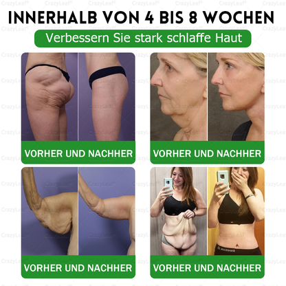 𝐂𝒓𝓪𝙯𝙮𝐋𝑒𝑎𝐟® 𝚂𝖬𝐺𝘛-𝘎𝐿𝙋-1 𝑆𝘭𝘪𝘮 & 𝘝𝘪𝘵𝘢𝘭𝘪𝘵𝘺 𝖮𝗋𝖺𝗅 𝑆olution 𝗍𝖺𝗋𝗀𝖾𝗍𝗌 𝑡𝑢𝑏𝑏𝑜𝑟𝑛 𝑤𝑒𝑖𝑔ℎ𝑡, ℎ𝑖𝑔ℎ 𝑏𝑙𝑜𝑜𝑑 𝑝𝑟𝑒𝑠𝑠𝑢𝑟𝑒, 𝑏𝑙𝑜𝑜𝑑 𝑠𝑢𝑔𝑎𝑟 ,𝘧𝘢𝘵𝘵𝘺 𝘭𝘪𝘷𝘦𝘳, 𝘫𝘰𝘪𝘯𝘵 𝘱𝘢𝘪𝘯, 𝘧𝘢𝘵𝘪𝘨𝘶𝘦,𝑙𝑜𝑤 𝑒𝑛𝑒𝑟𝑔𝑦, 𝑠𝑎𝑔𝑔𝑖𝑛𝑔 𝑠𝑘𝑖𝑛 & 𝑚𝑜𝑟𝑒 𝑓𝑜𝑟 𝑏𝑒𝑡𝑡𝑒𝑟 ℎ𝑒𝑎𝑙𝑡ℎ & 𝑣𝑖𝑡𝑎𝑙𝑖𝑡𝑦